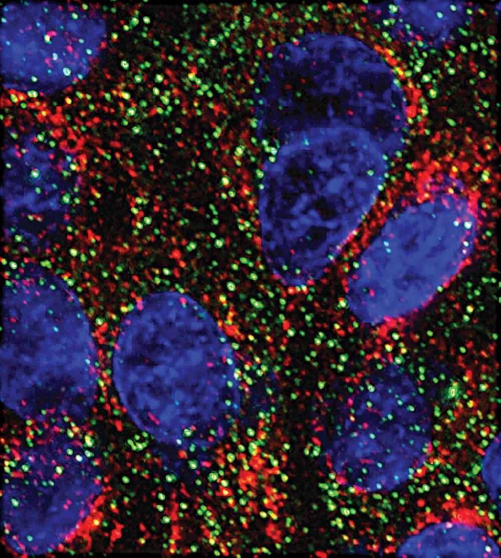 MicroARN frenan el crecimiento del cáncer de páncreas en laboratorio